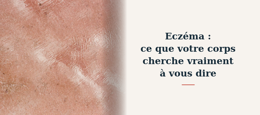eczéma